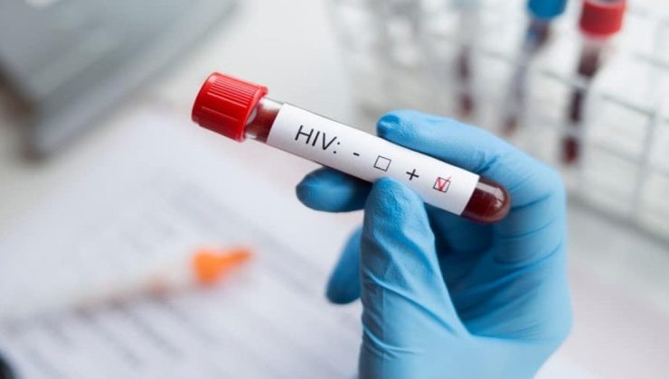 HIV Nedir? Bulaş Yolları Nasıl Gerçekleşir?